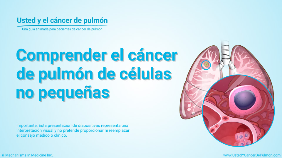 Presentación de diapositivas - Comprender el cáncer de pulmón de células no pequeñas