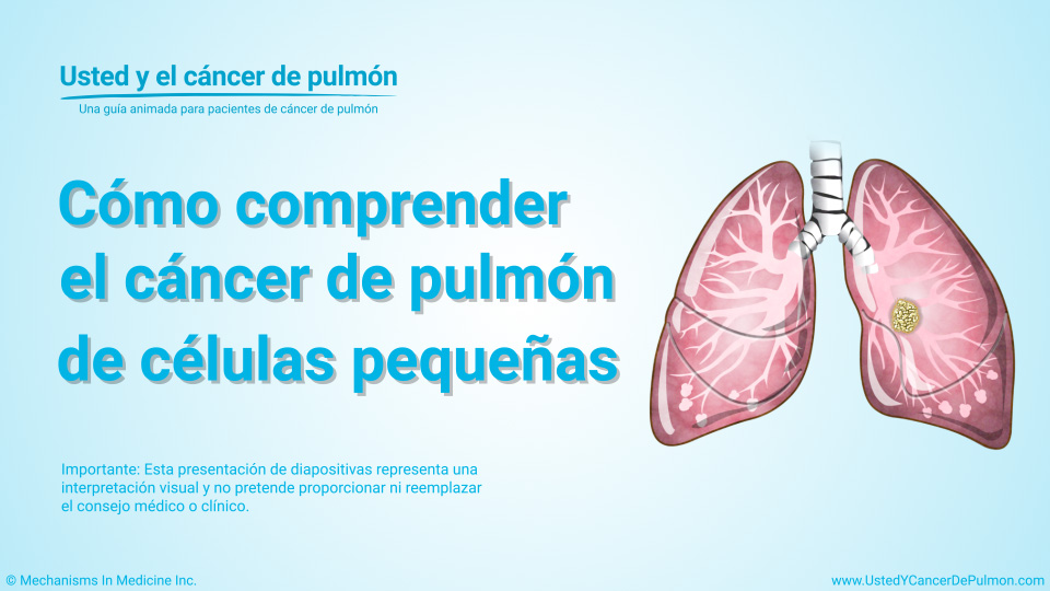 Presentación de diapositivas - Comprender el cáncer de pulmón de células pequeñas