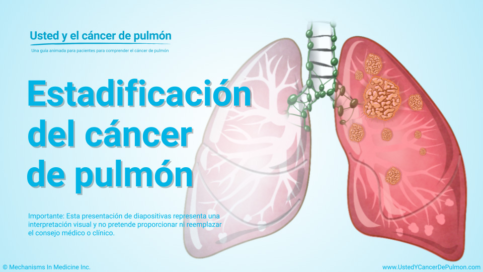 Presentación de diapositivas - Estadificación del cáncer de pulmón