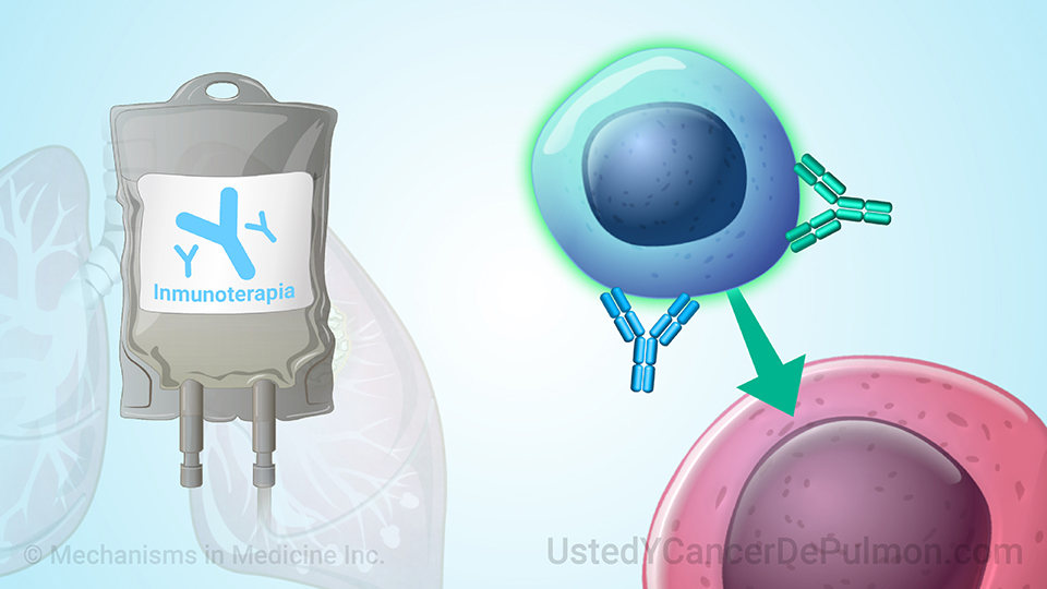 Inmunoterapia para el cáncer de pulmón