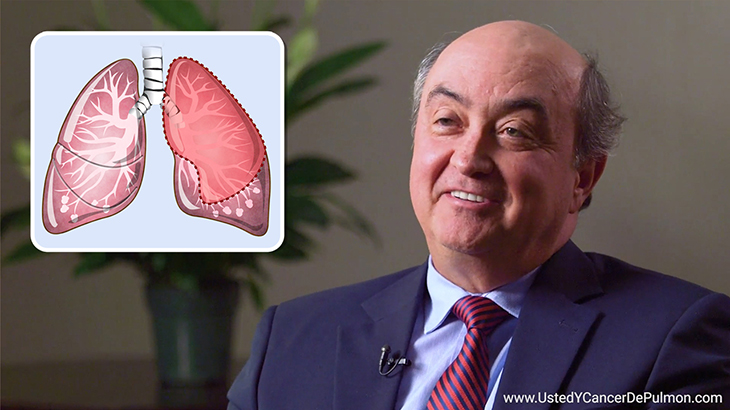 Video de expertos - ¿Qué factores determinan el alcance de la cirugía de cáncer de pulmón?