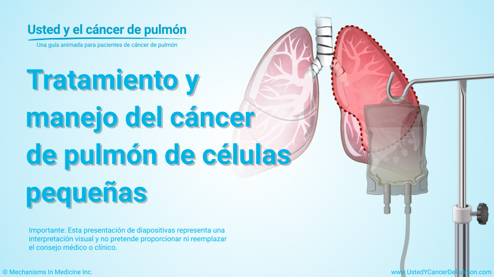 Presentación de diapositivas - Tratamiento y manejo del cáncer de pulmón de células pequeñas