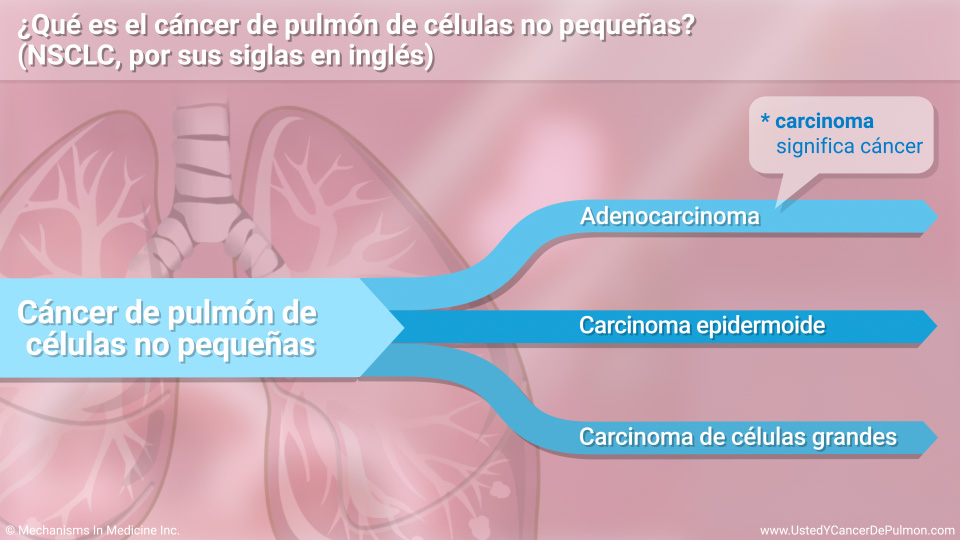 ¿Qué es el cáncer de pulmón de células no pequeñas (NSCLC)?