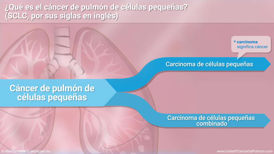 ¿Qué es el cáncer de pulmón de células pequeñas (SCLC)?