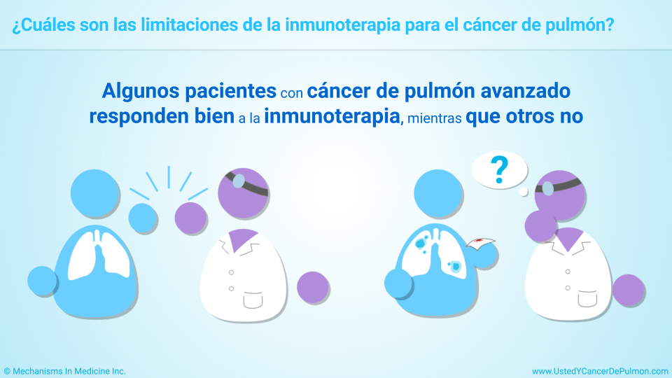 ¿Cuáles son las limitaciones de la inmunoterapia para el cáncer de pulmón?