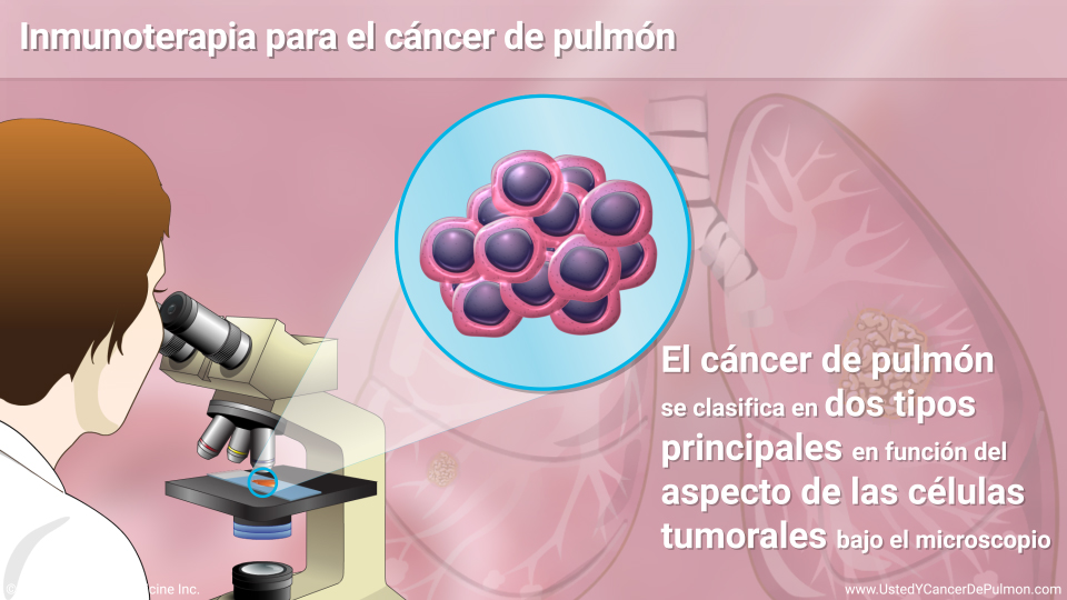 Inmunoterapia para el cáncer de pulmón