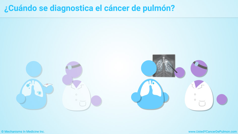 ¿Cuándo se diagnostica el cáncer de pulmón?