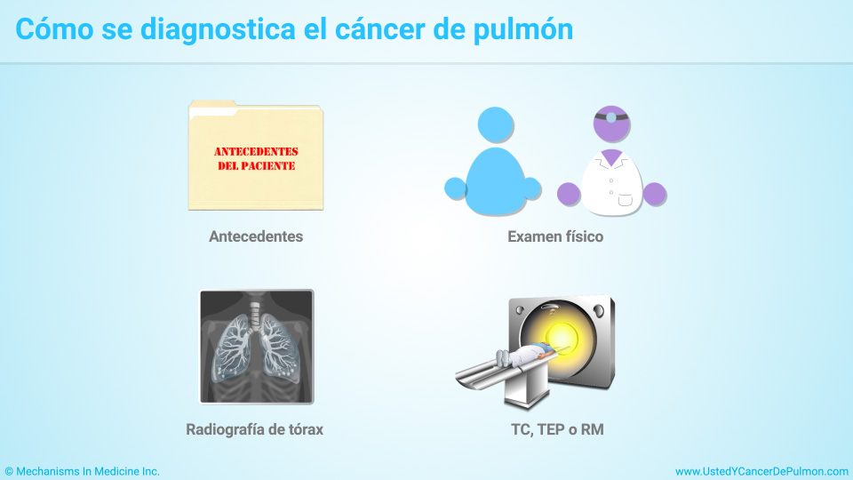 Cómo se diagnostica el cáncer de pulmón