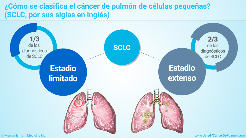 ¿Cómo se clasifica el cáncer de pulmón de células pequeñas?