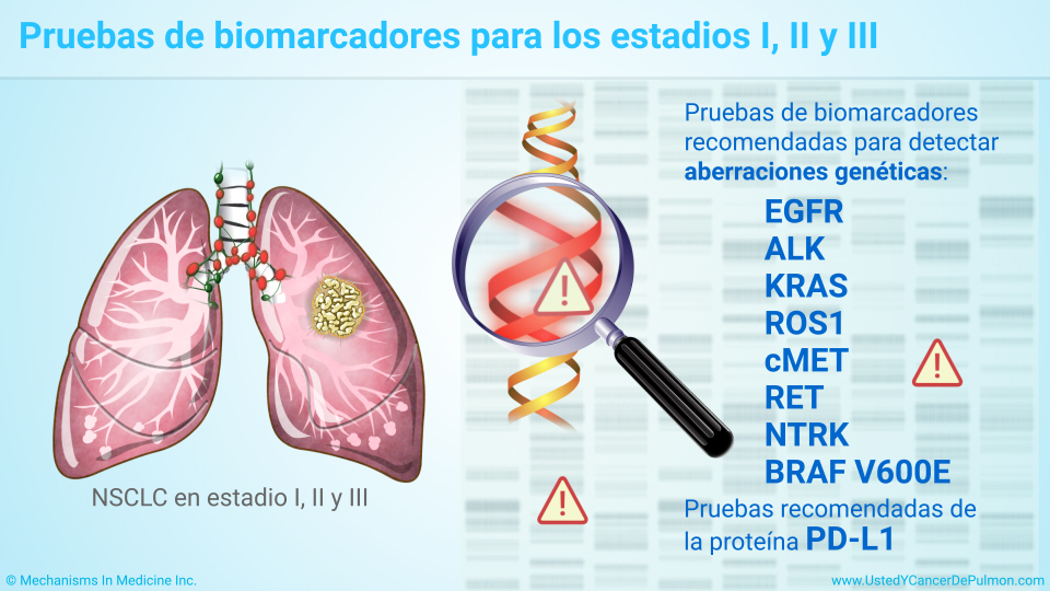 Pruebas de biomarcadores para los estadios I, II y III