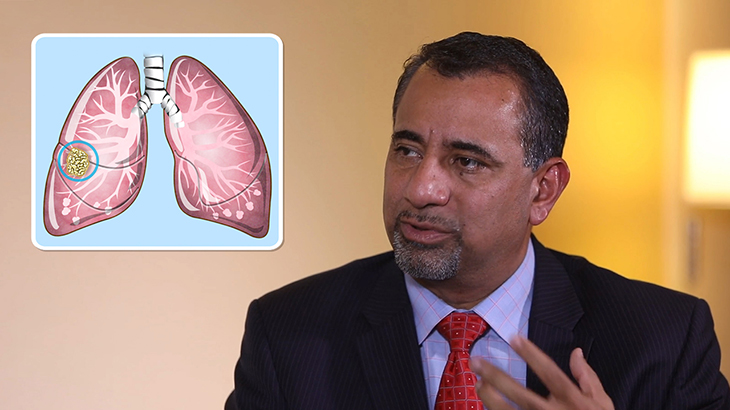 ¿Qué es el cáncer de pulmón de células no pequeñas?